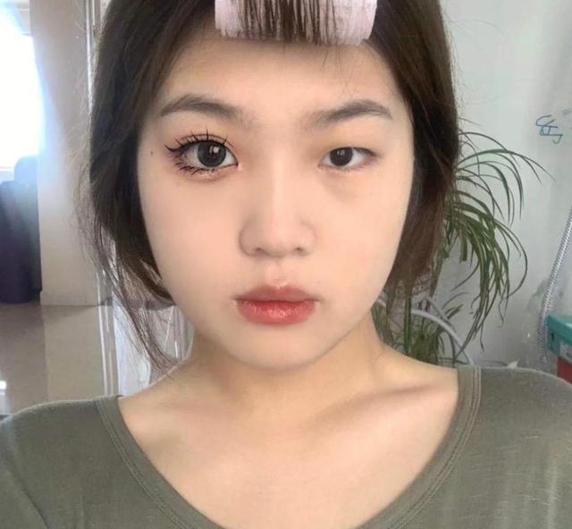 眼睛一大一小怎么办(大小眼)