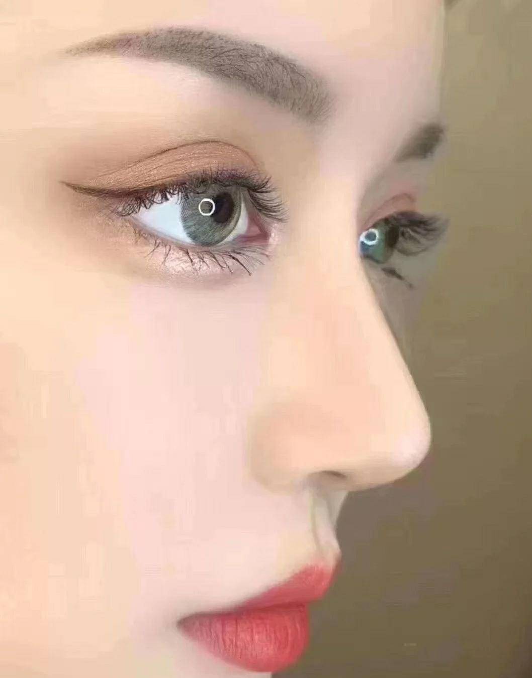 作为整容模板,绝对是颜值担当,它就是水滴鼻,鼻子的形状有点像水滴,看