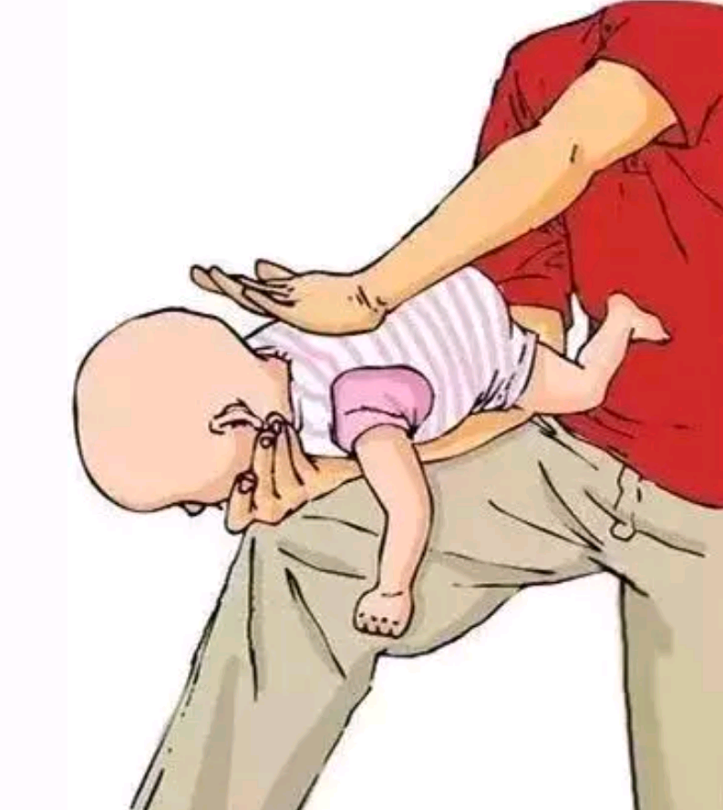 20天母乳宝宝经常呛奶,妈妈以为的消化不良,却引起了吸入性肺炎