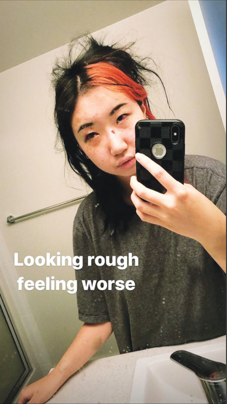 被加拿大警察暴力执法的华人女生：一直噩梦不断，希望踩头女警被革职；皇家骑警：涉事女警已被调到行政岗