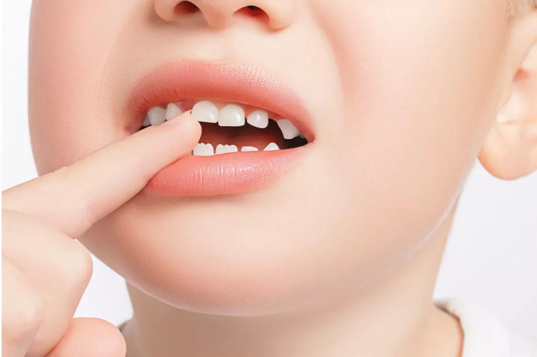 孩子鼻塞鼻炎反復不好，這個小方法最管用？