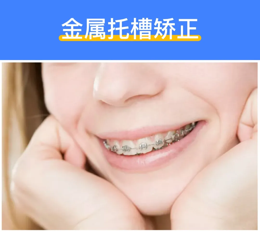 深度揭秘:牙齿矫正到底需要多少钱?