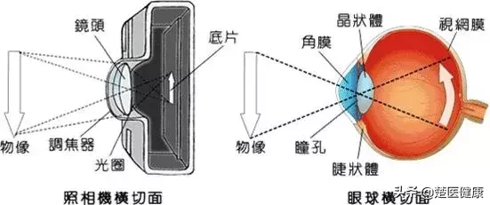公立医院眼科医生揭秘:近视激光手术到底靠不靠谱