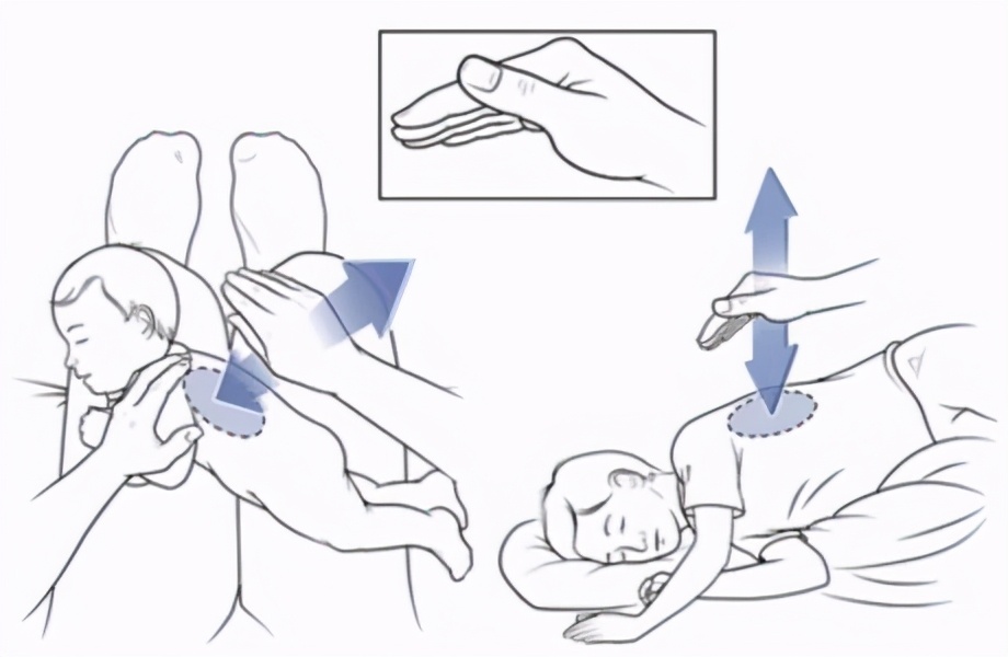 拍背排痰的手法图片图片
