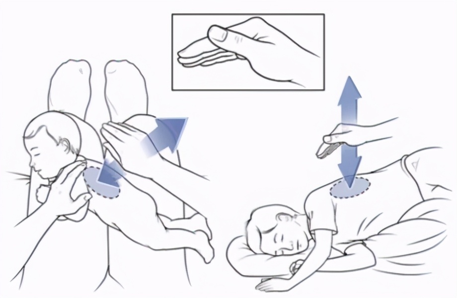 03拍背,把痰震出来