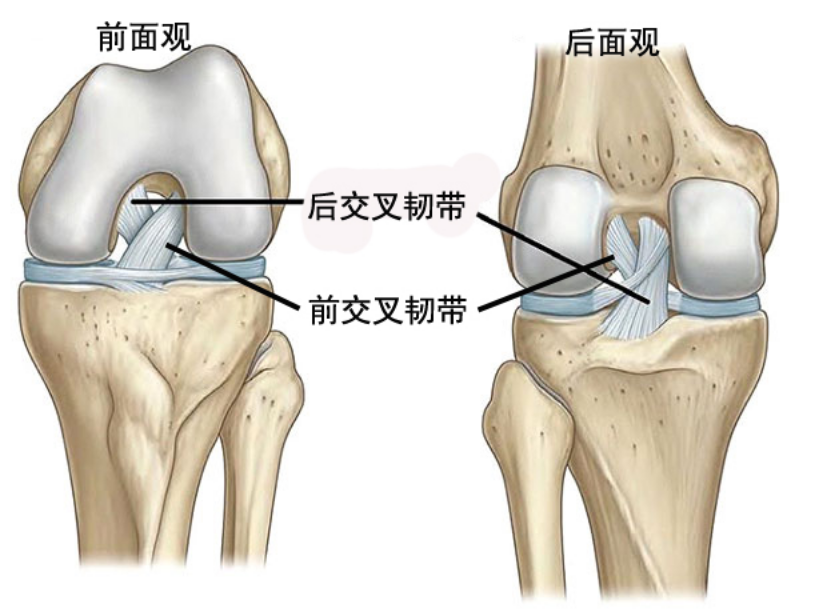 交叉韧带损伤