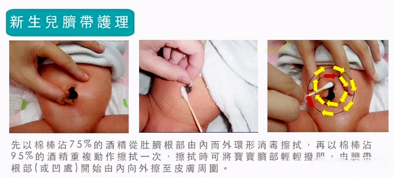 宝宝出生后,会剪断和妈妈连接的脐带,在宝宝肚子上就会留下个待长好的