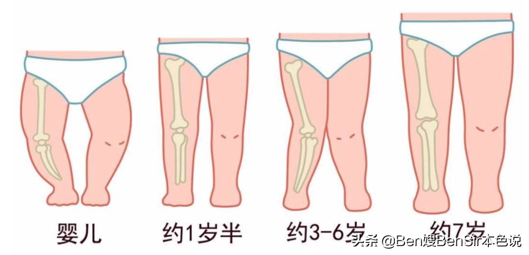 学步车几个月可以坐？引发家庭大战你也得顶住了，这车真的坐不得