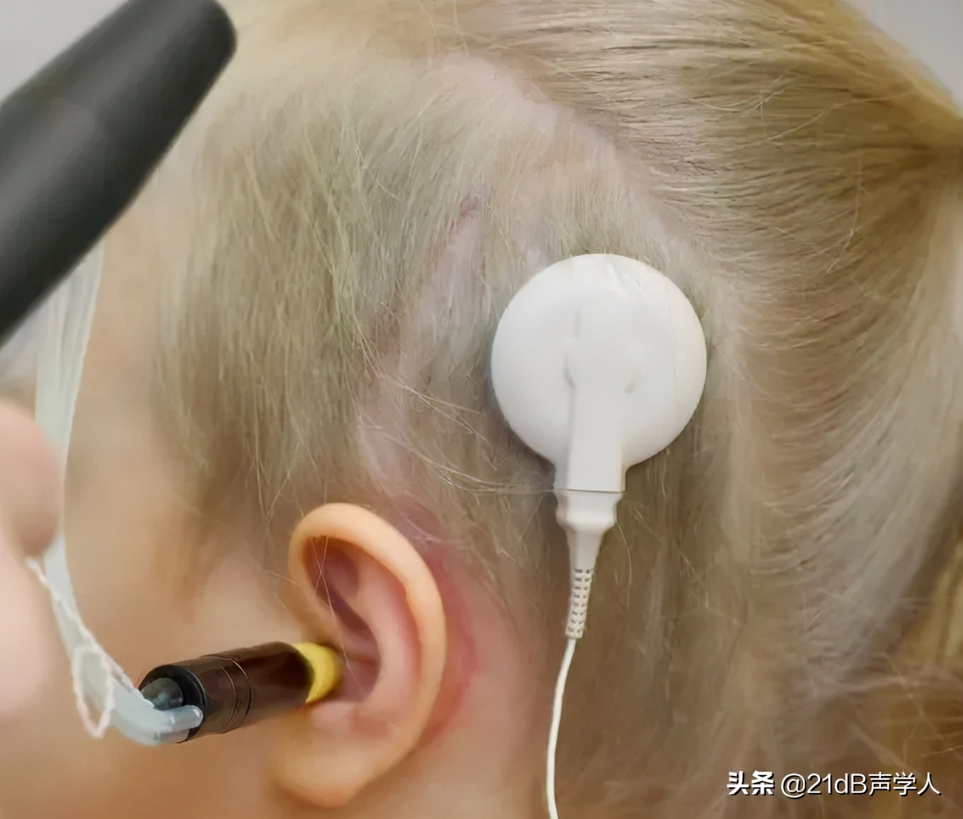 用人工耳蜗听音乐为何效果大不同?
