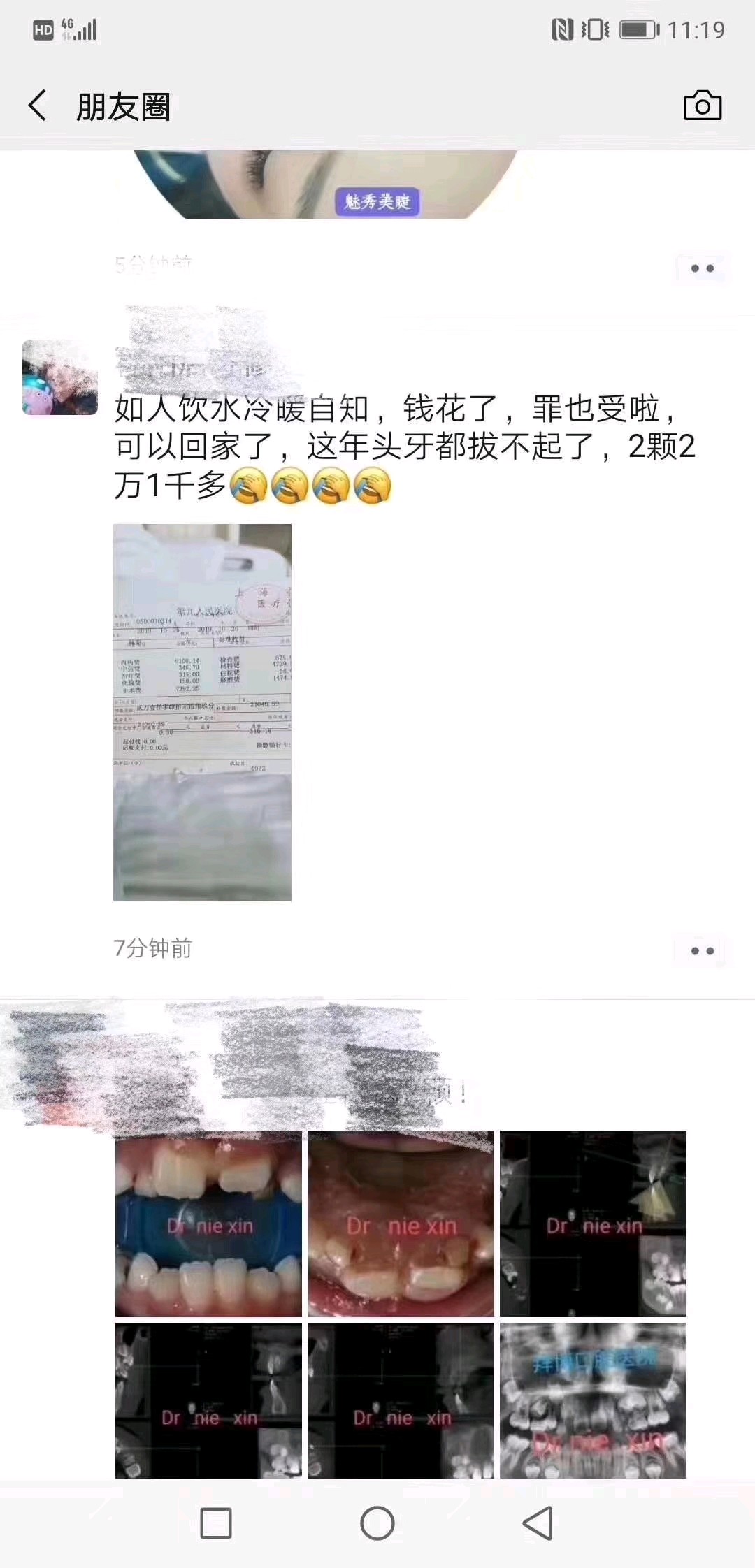 拔2颗智齿花了两万多？为什么拔智齿这么贵？