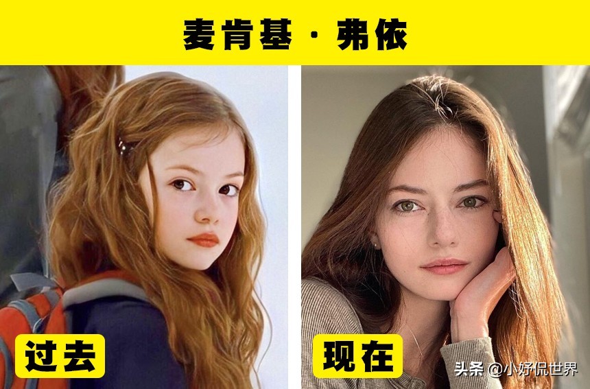 全球七大童星成长对比：从稚嫩幼童到青春少年的蜕变之路
