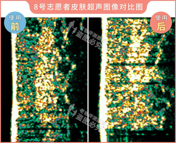 网红家用美容仪真的有效吗？2个多月的跟踪实测结果来了