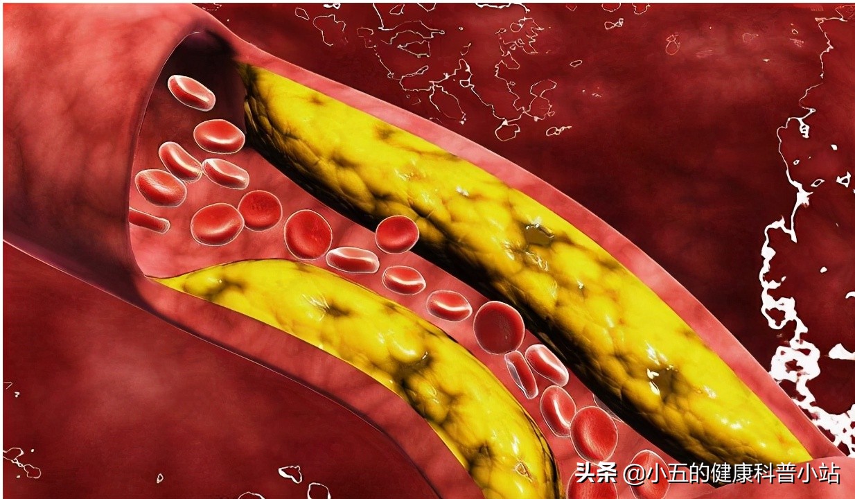 补肾填精？延年益寿？聊一聊争议中的中成药——金水宝胶囊