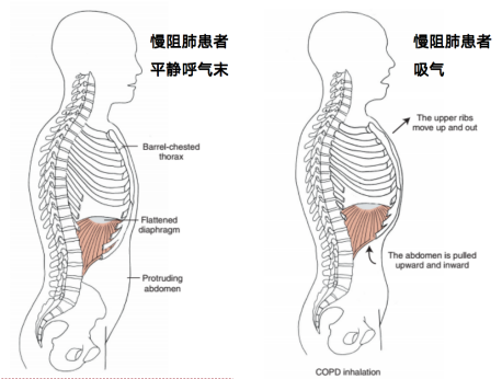 胸鎖乳突肌,斜方肌,斜角肌,肋間外肌,胸骨旁肋間肌以及膈肌