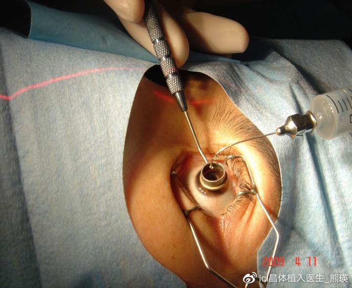 高考升学体检将至，你还在纠结选择哪种手术吗？