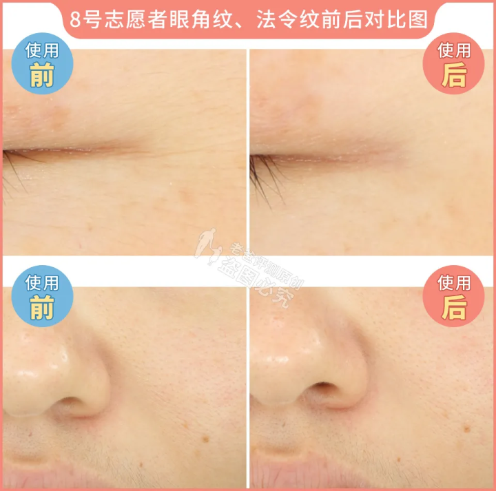 网红家用美容仪真的有效吗？2个多月的跟踪实测结果来了