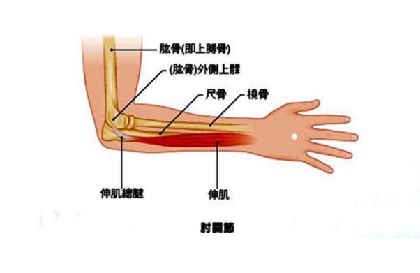 拔火罐能治网球肘吗(网球肘，不可怕，及时休息是关键)