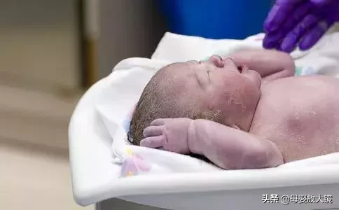 红斑、脱皮、痤疮…新生儿最易出现的10种皮肤问题，宝妈护理必备