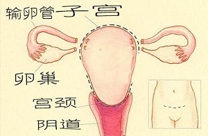 子宫切除，你舍得吗？