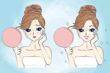 2块钱的红霉素眼膏可以祛痘痘,是真的么?