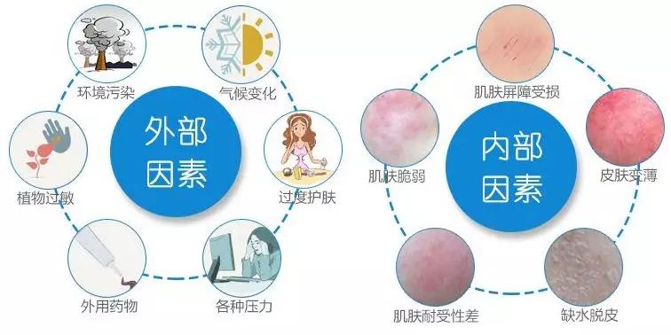 告别春季敏感皮肤红、痛、痒问题