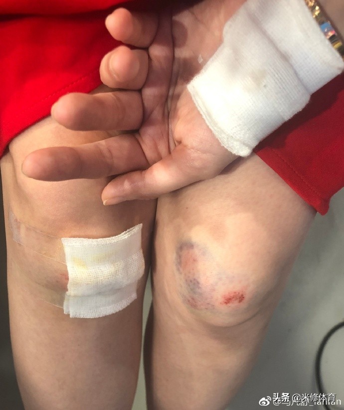 马凡舒和谁搭档主持世界杯(《天下足球》美女主持马凡舒受伤,膝盖青紫