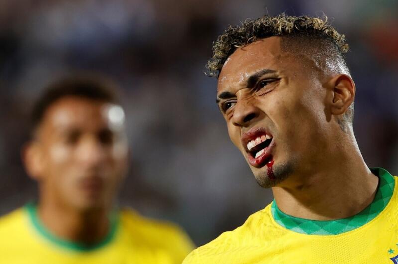 比达尔飞踹对手脸部遭处罚(暴力的南美足球！比达尔腾空1米8爆头，巴西前锋遭肘击满口鲜血)