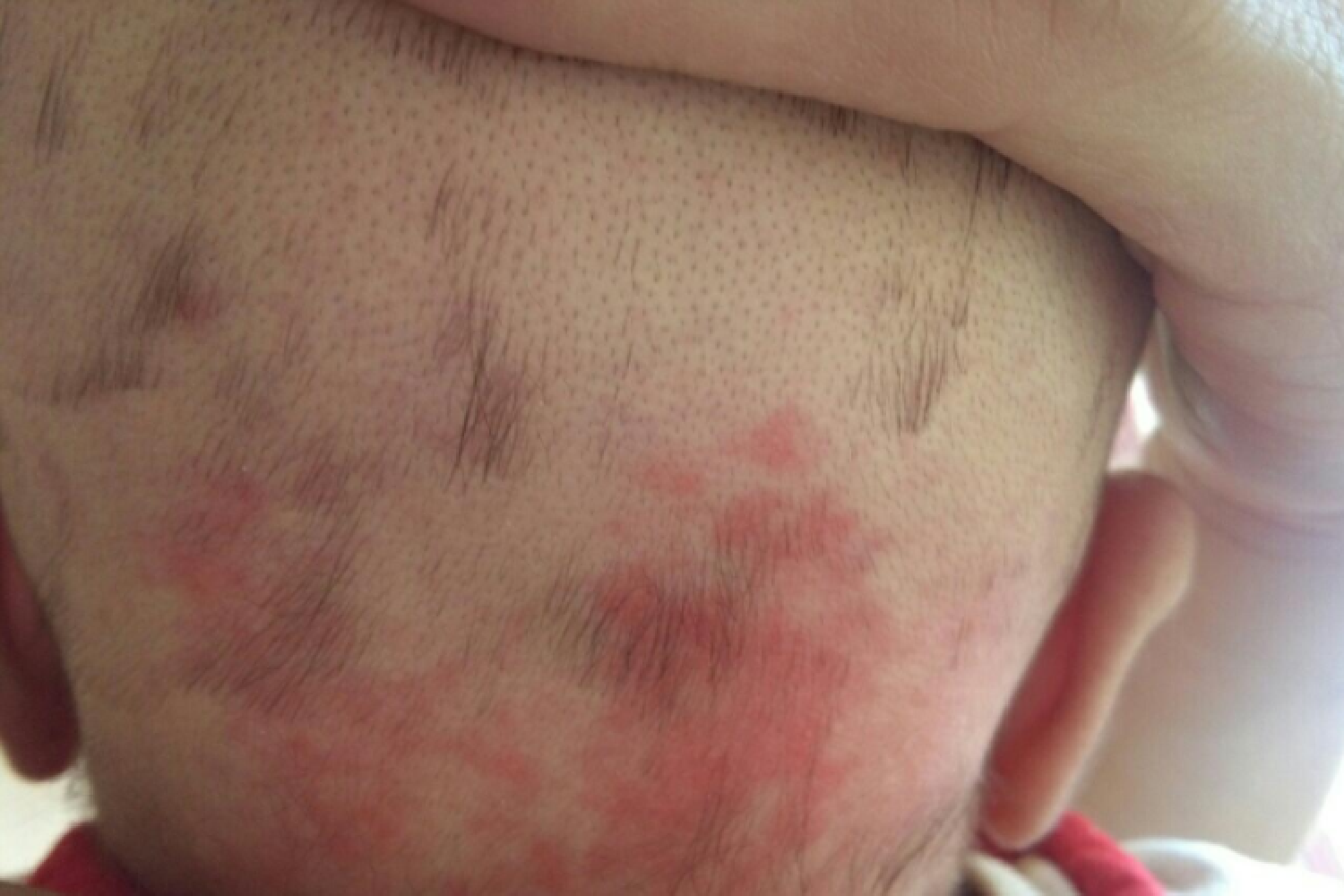 婴儿头发黄(为何宝宝的头发稀疏发黄) - 乐宝宝贝