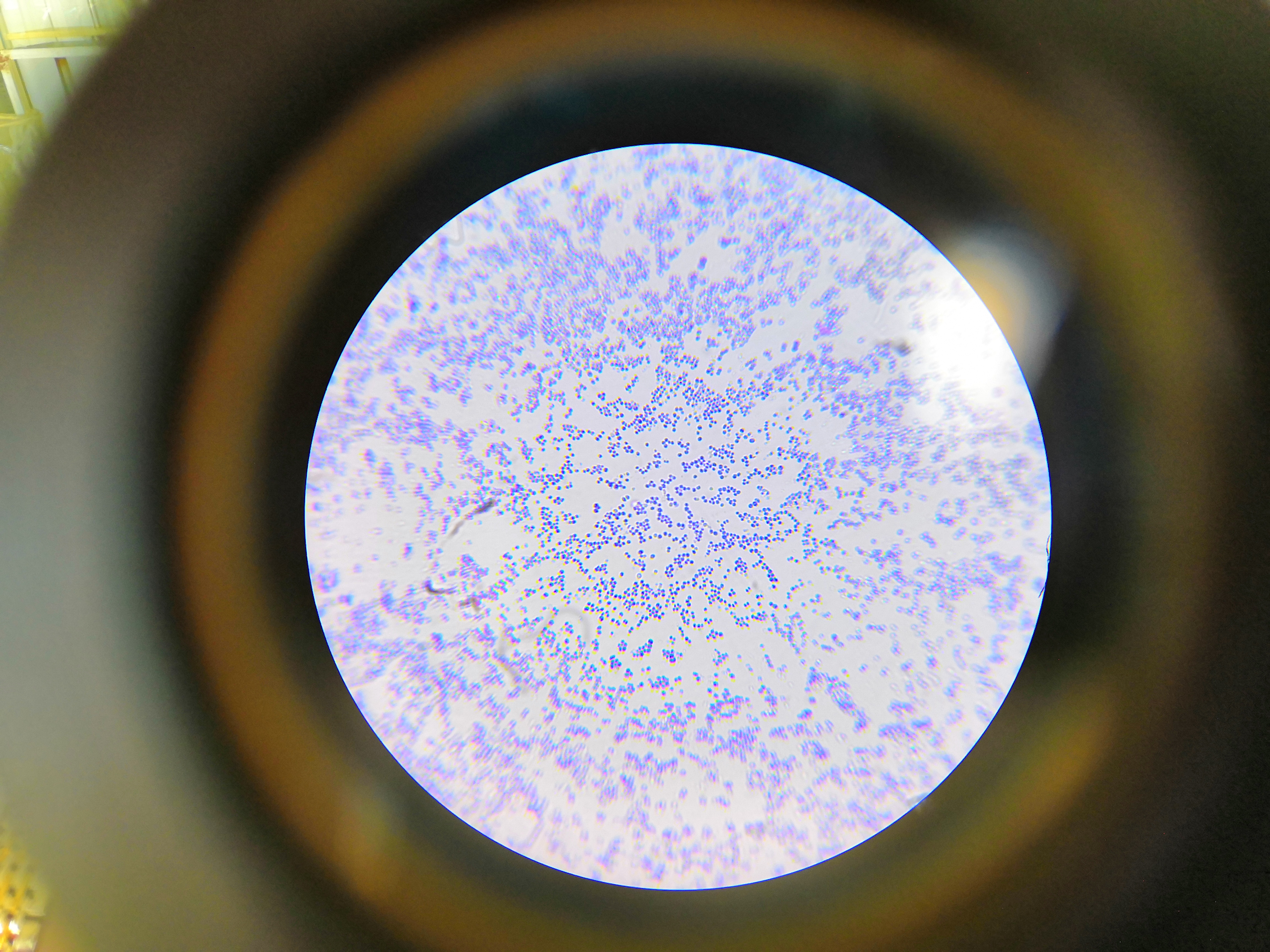 显微镜下的太阳--革兰氏染色