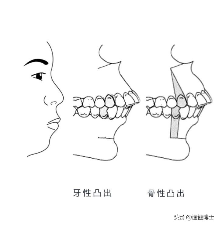 同样是凸嘴，为什么这些女明星就这么漂亮？两招教你摆脱土气脸