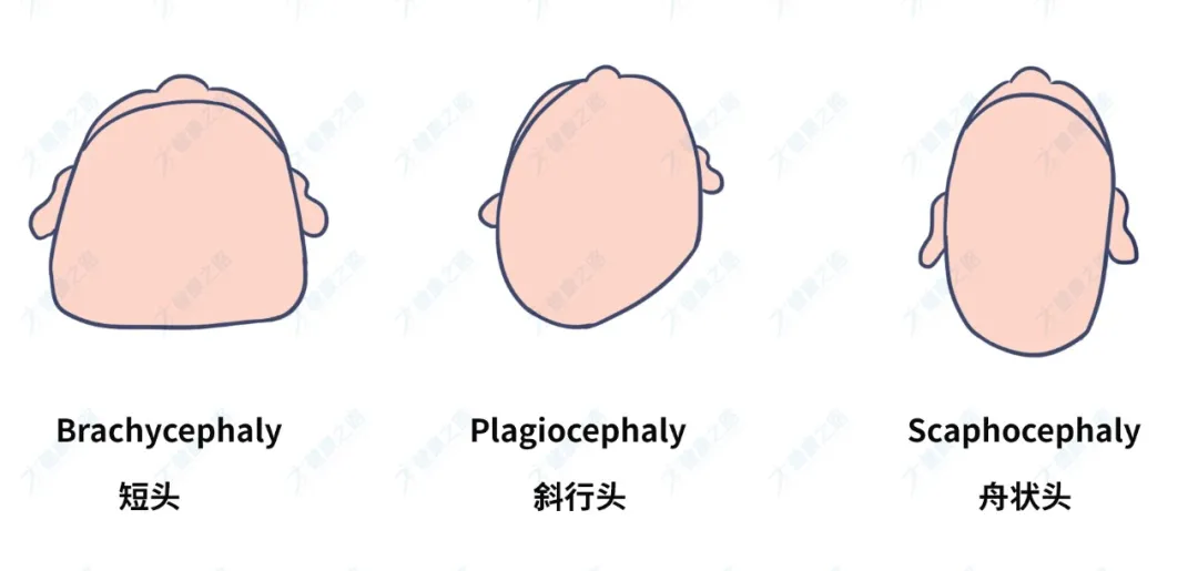 为什么老人非要给孩子睡“扁头”？扁头和圆头有什么区别，哪个好