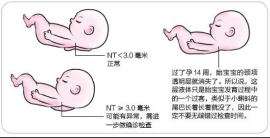 十三周男女胎儿区别图图片