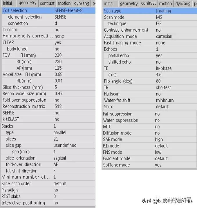 「MRI技术 」做头颅磁共振,为什么这个地方伪影这么重呢?