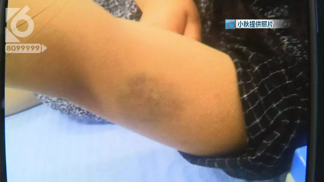 少女疑遭同学毒打 冷水泼醒逼迫下跪