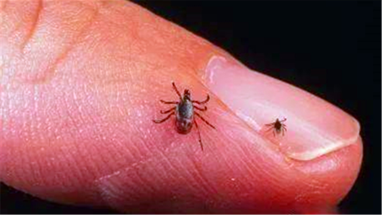 同人类共进化,30年前农村人人都长的虱子,为何如今看不到了?