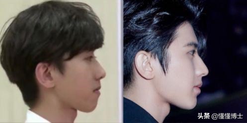 同样是凸嘴，为什么这些女明星就这么漂亮？两招教你摆脱土气脸