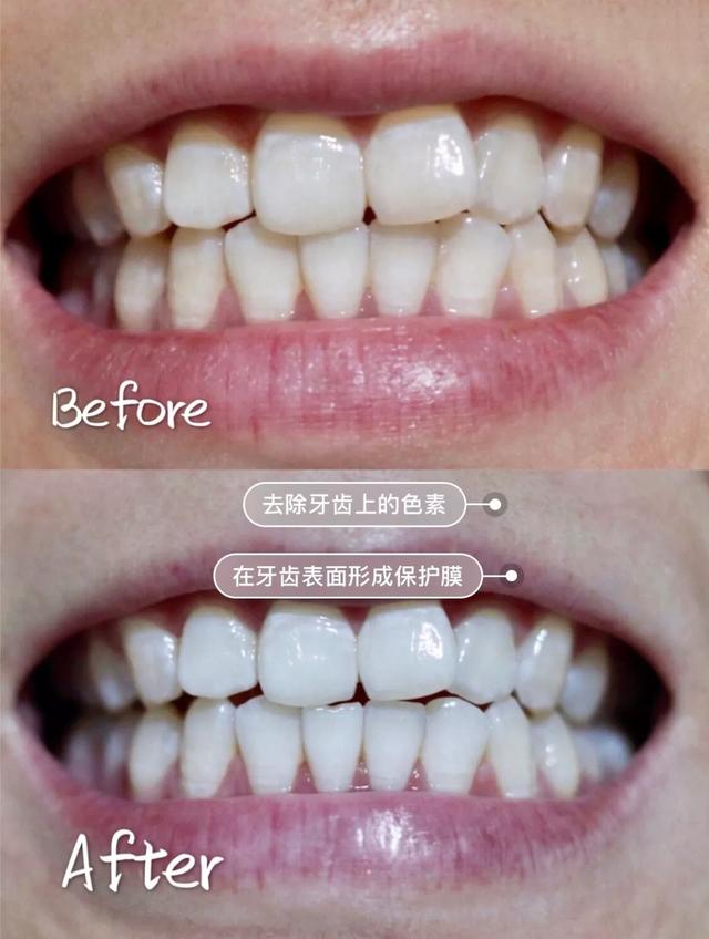 玉米男孩和芝麻女孩,玉米粒男孩