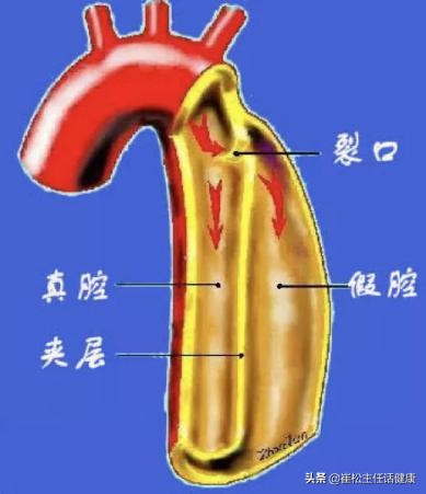 不想去医院第二弹！胸部不适的自我诊察