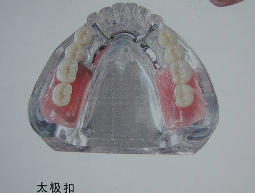 各类假牙汇总，最贵的假牙价值近百万