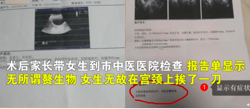 被手术女生疑遭莆田系医院,被手术女生疑遭莆田系医院8