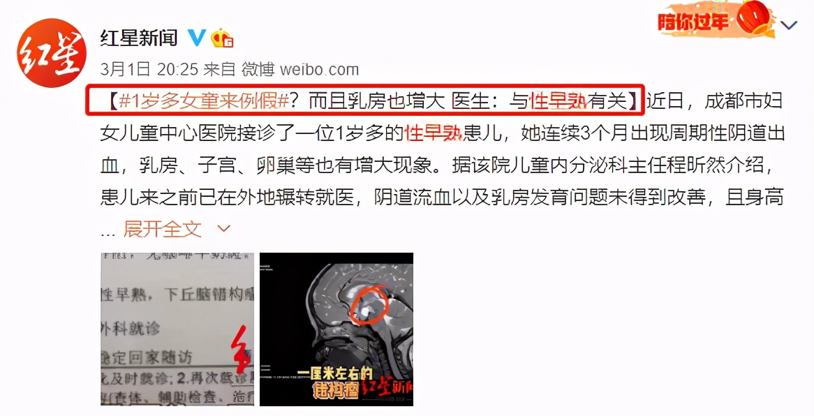 1岁女童竟来例假？孩子有这5种表现，警惕性早熟