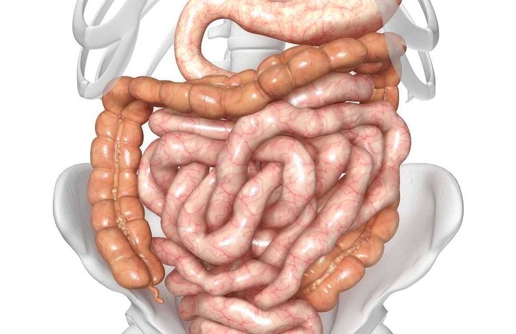 肠梗阻的症状 肠梗阻算大病吗-小螳螂百科网