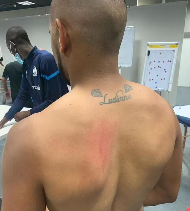 法甲尼斯与马赛比赛闹出大乱子，数十名尼斯球迷冲入场内打架，多名马赛球员受伤！点燃火药桶的又是他