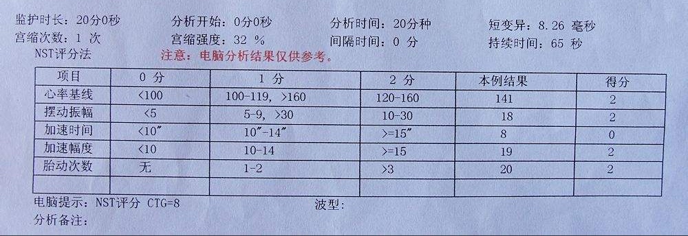 胎心监护的必要性是什么？这个时间和注意事项很重要，孕妇要知道