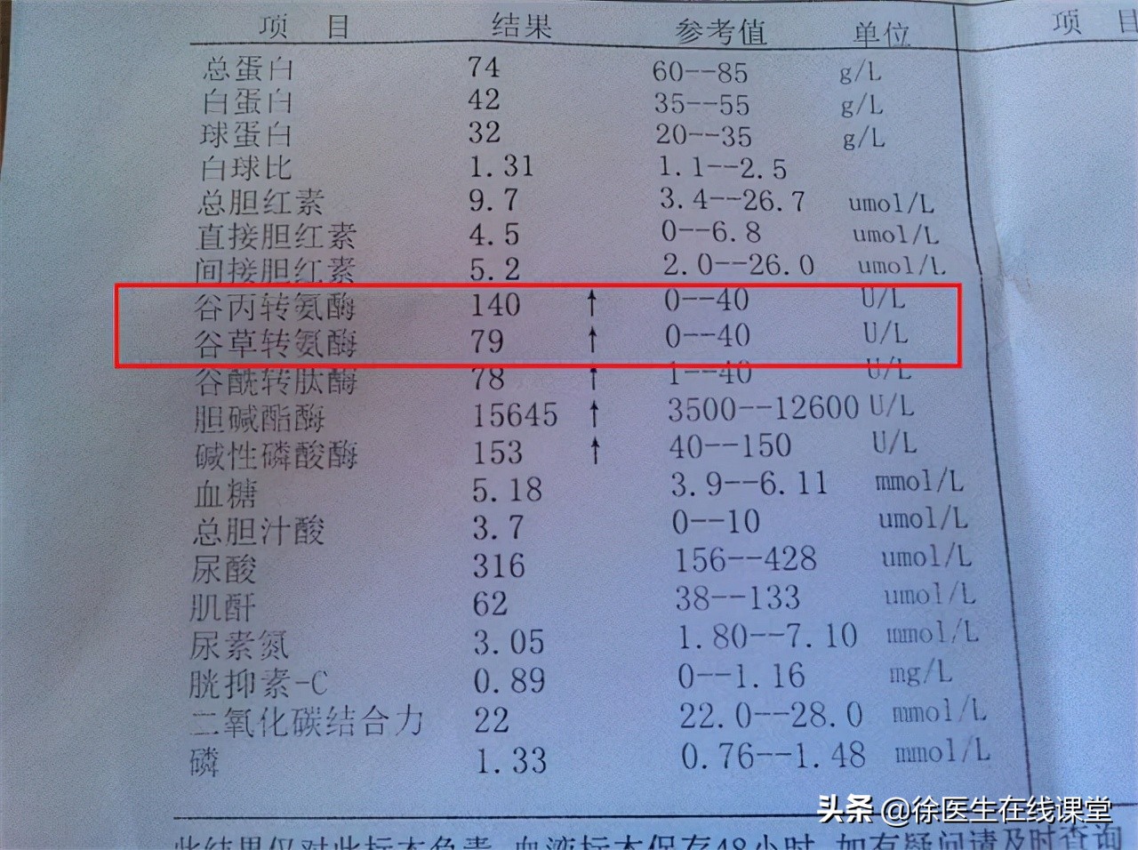 乙肝严不严重，不是看表面抗原和病毒DNA：你需要看这些检查