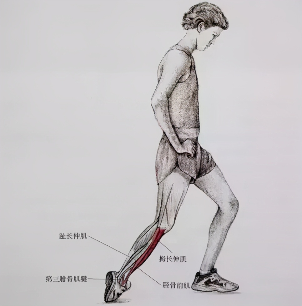 深蹲是健身动作之王，小腿状态不良有点儿难办，锻炼内容需微调