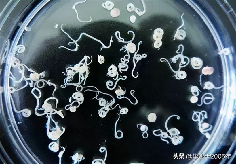 随意生吃鱼,虾,蟹,贝等水产品对身体健康造成的危害