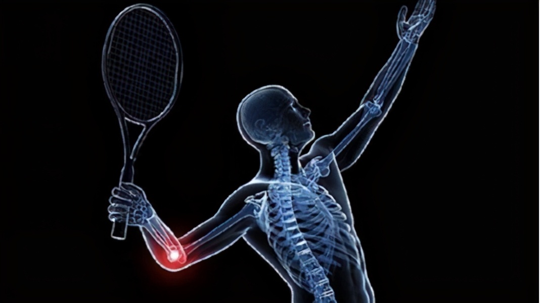 羽毛球运动容易出现哪些损伤(羽毛球运动中易出现的损伤症状、原因以及预防措施)