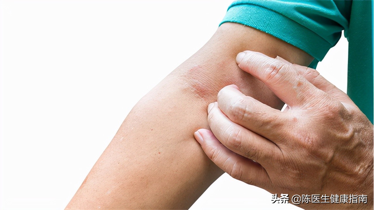 玻璃丝弄在皮肤上怎么办「玻璃丝弄到皮肤上怎么办」-友友