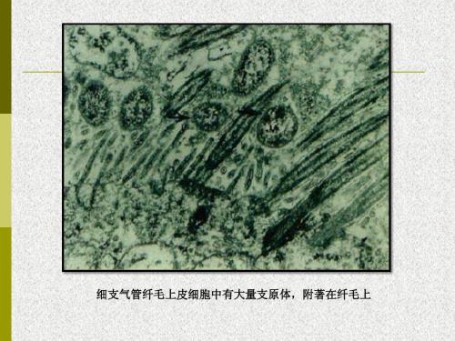 支原体丨虽不会引起猪的死亡，却是其它呼吸系统疾病的导火索！